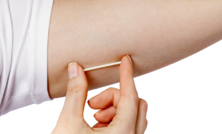 Fingers holding up Nexplanon birth control